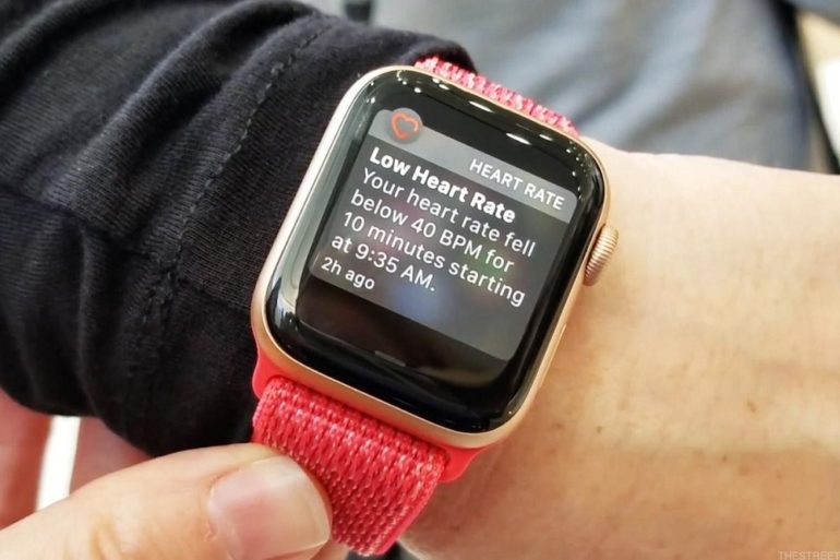 applewatch