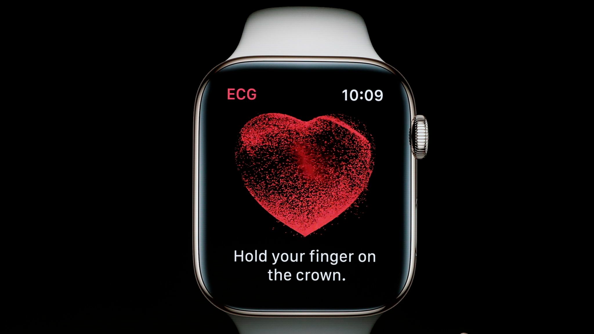 Apple Watch heart rate monitor saves woman from blockage that had 88% chance of killing her